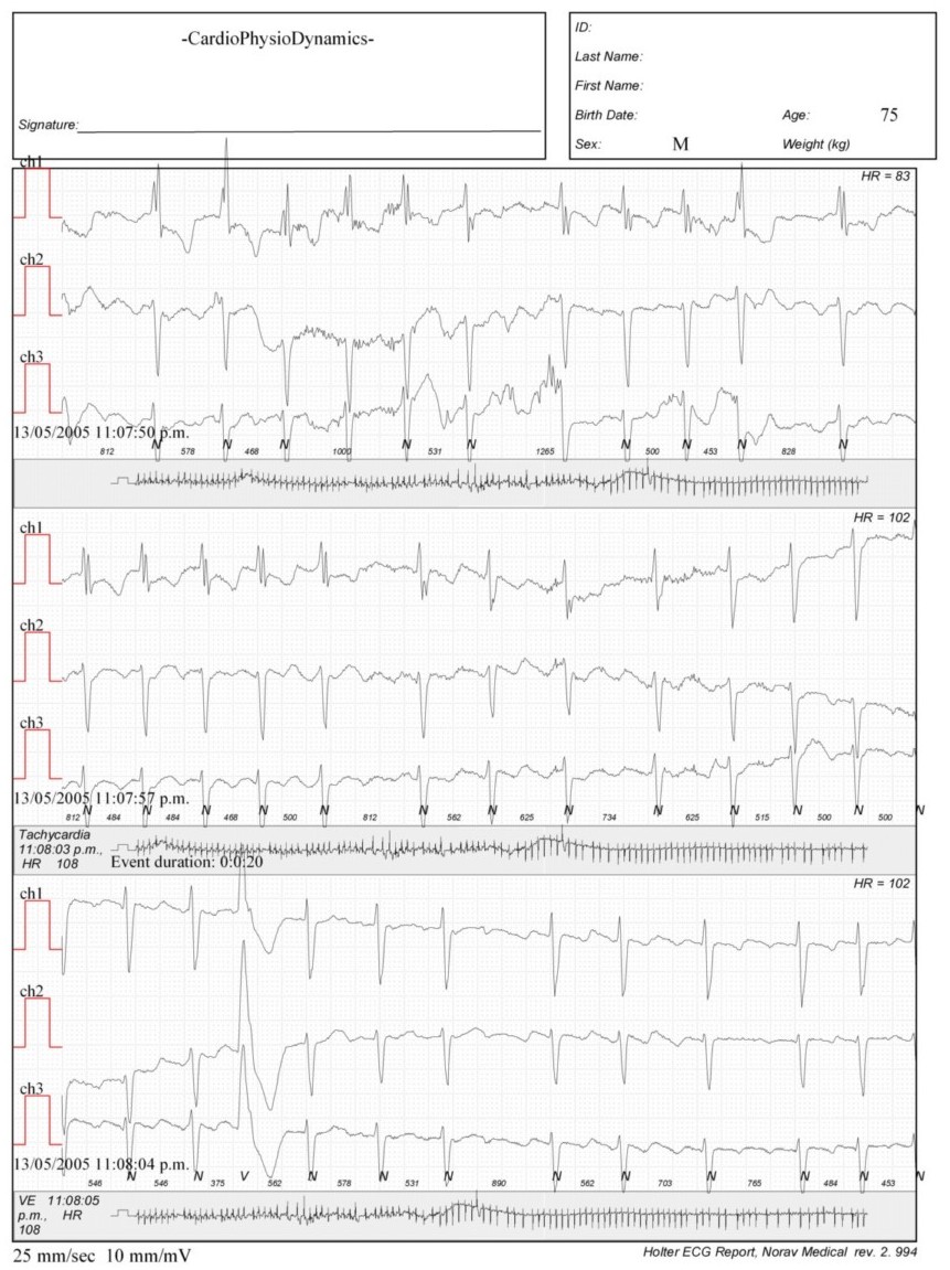 Martinez.Duncker.ECG1_1.jpg