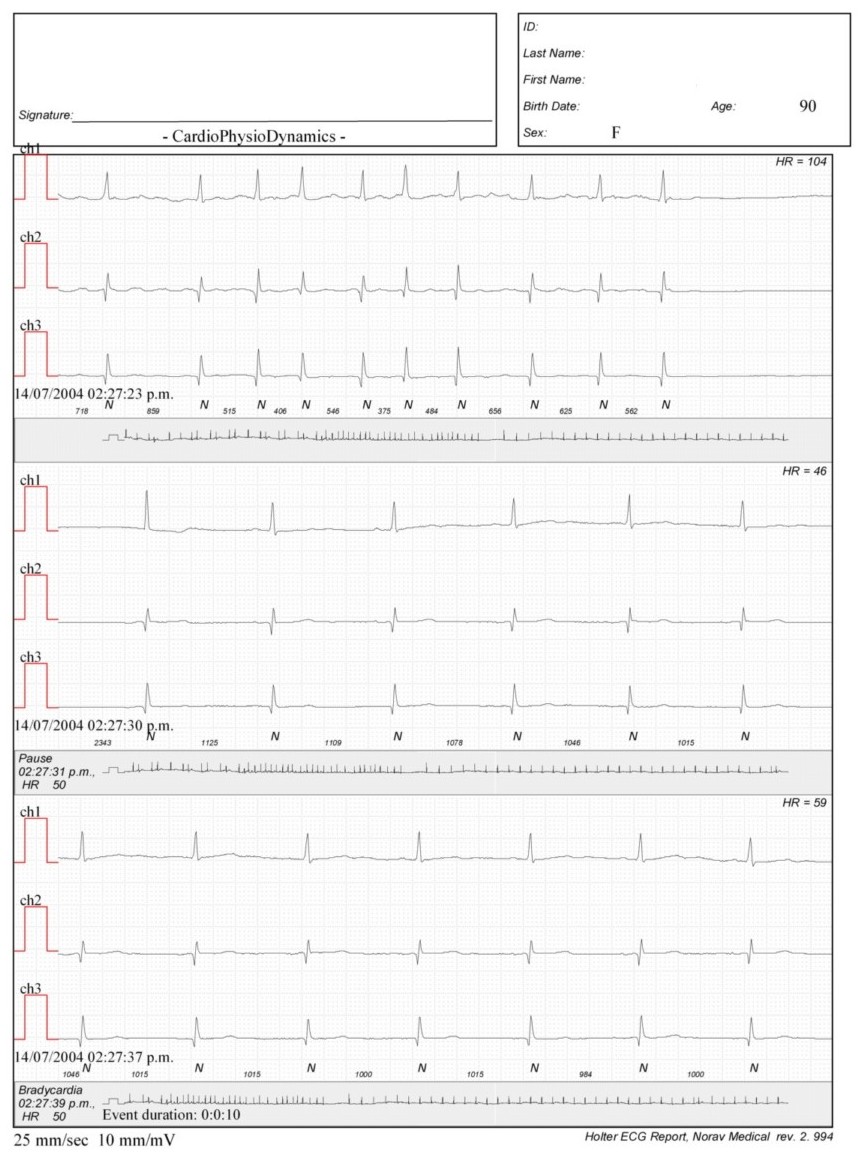 Martinez.Duncker.ECG1_1.jpg