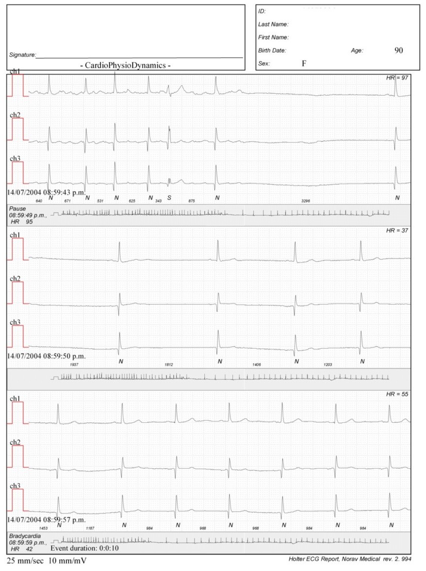 Martinez.Duncker.ECG1_1.jpg