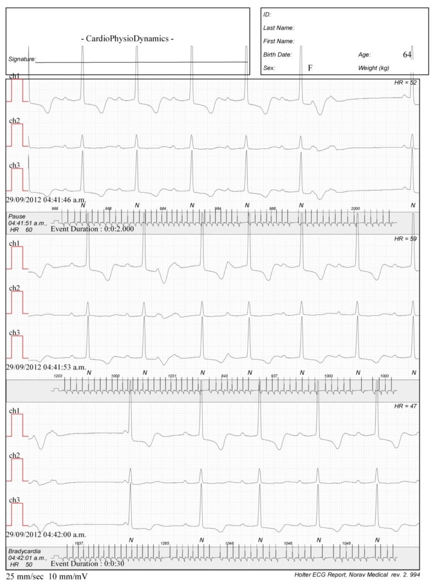 Martinez.Duncker.ECG1_1.jpg