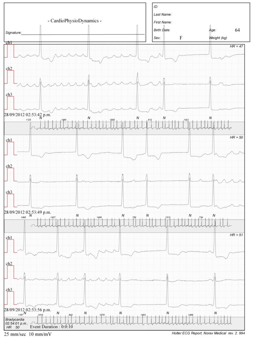 Martinez.Duncker.ECG1_1.jpg