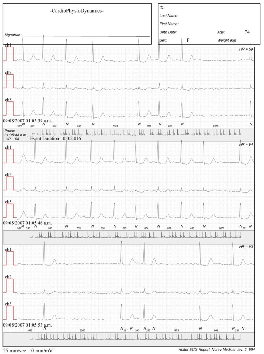 Martinez.Duncker.ECG1_1.jpg