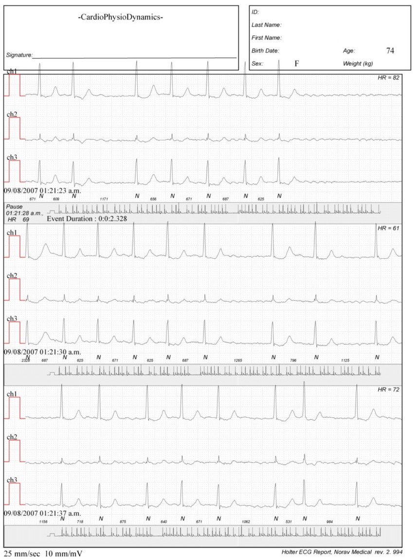 Martinez.Duncker.ECG1_1.jpg