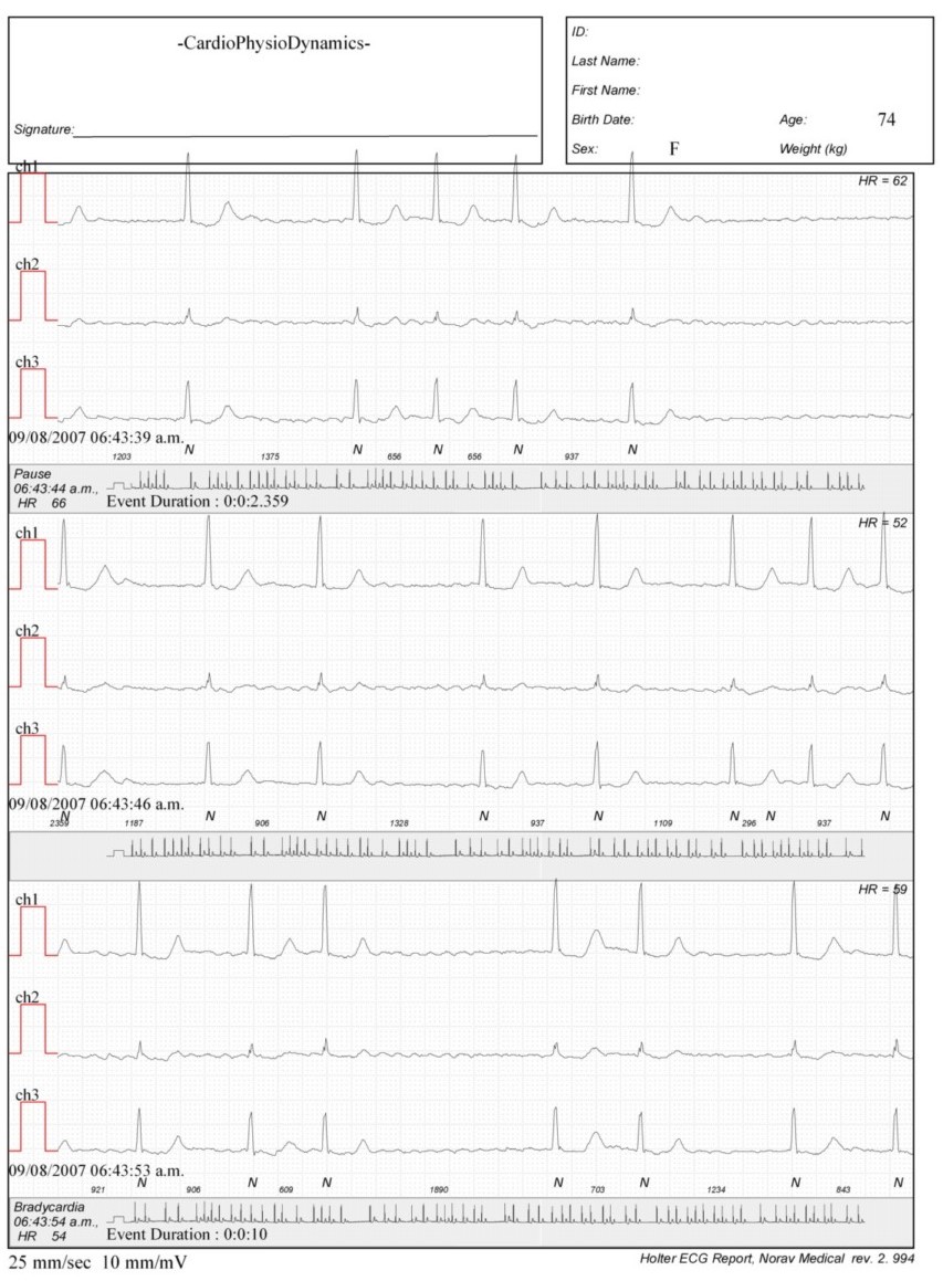 Martinez.Duncker.ECG1_1.jpg