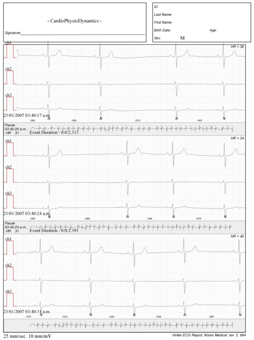 Martinez.Duncker.ECG1_1.jpg