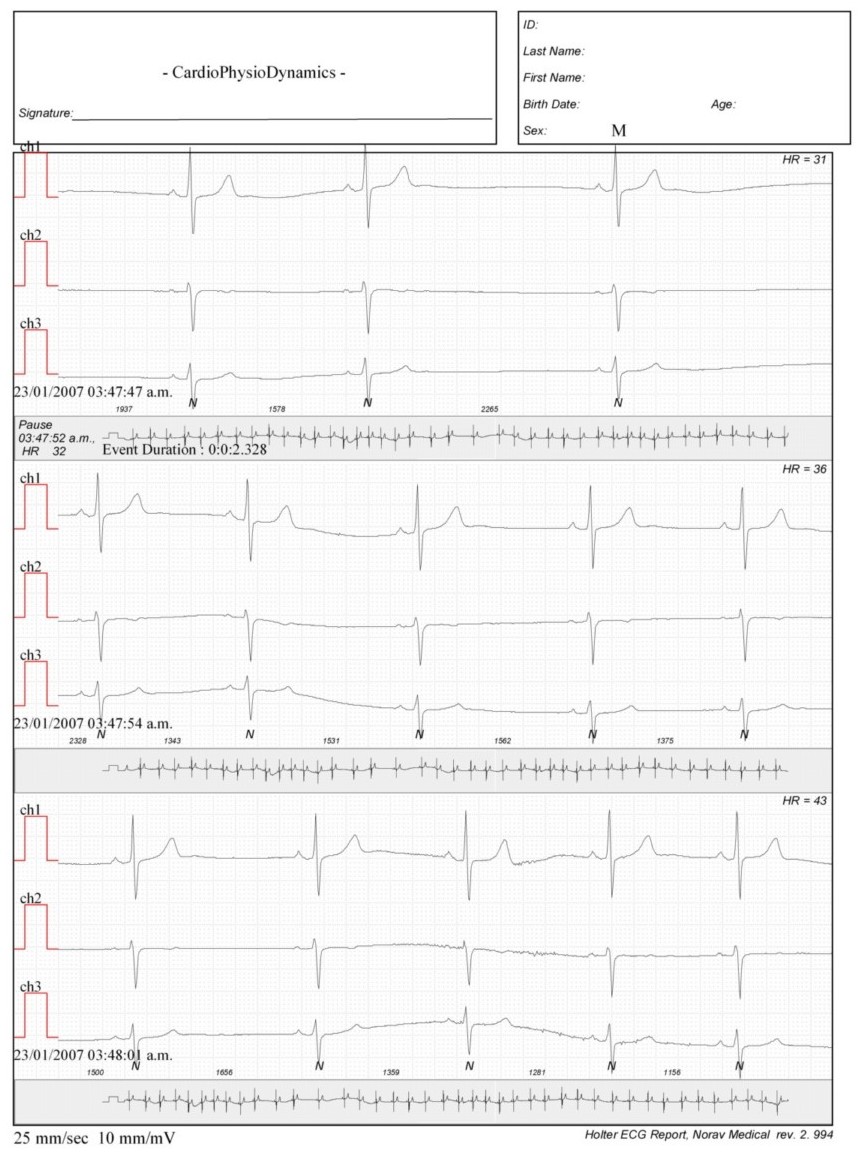 Martinez.Duncker.ECG1_1.jpg