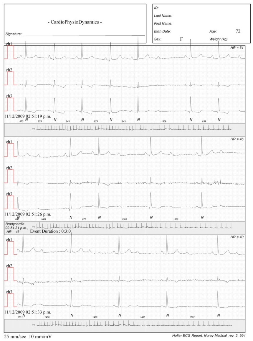 Martinez.Duncker.ECG1_1.jpg