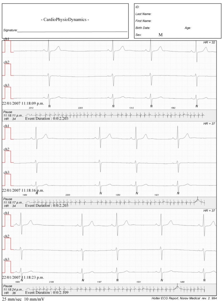 Martinez.Duncker.ECG1_1.jpg