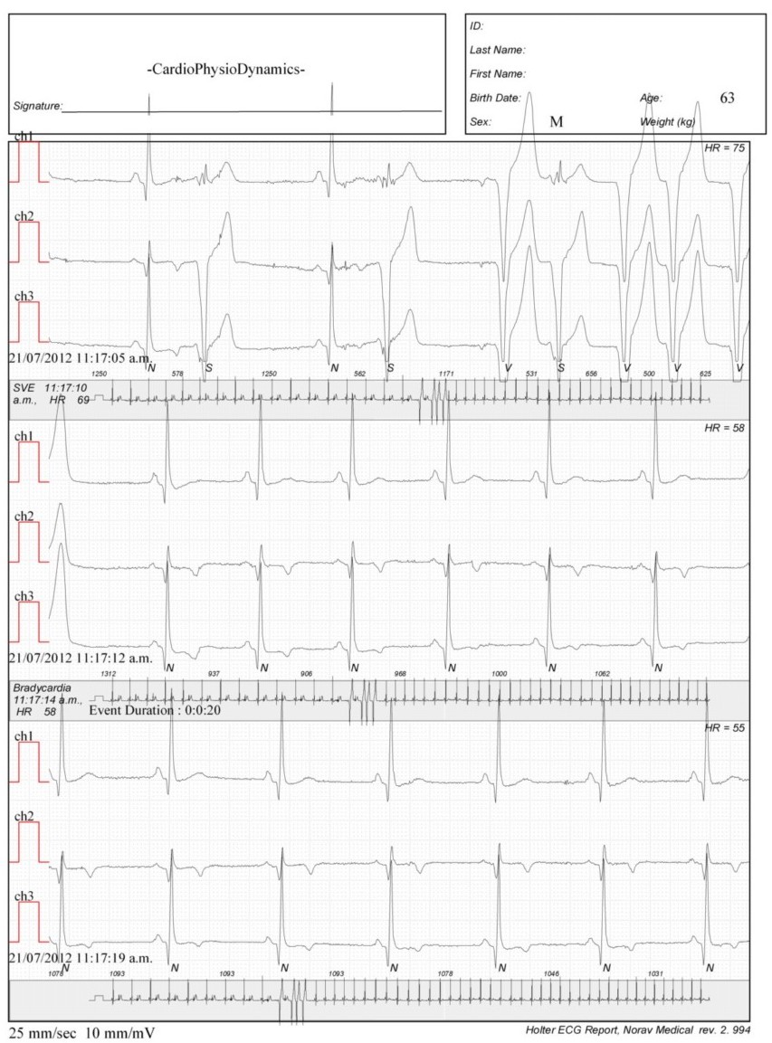 Martinez.Duncker.ECG1_1.jpg