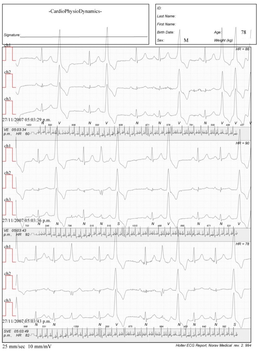 Martinez.Duncker.ECG1_1.jpg