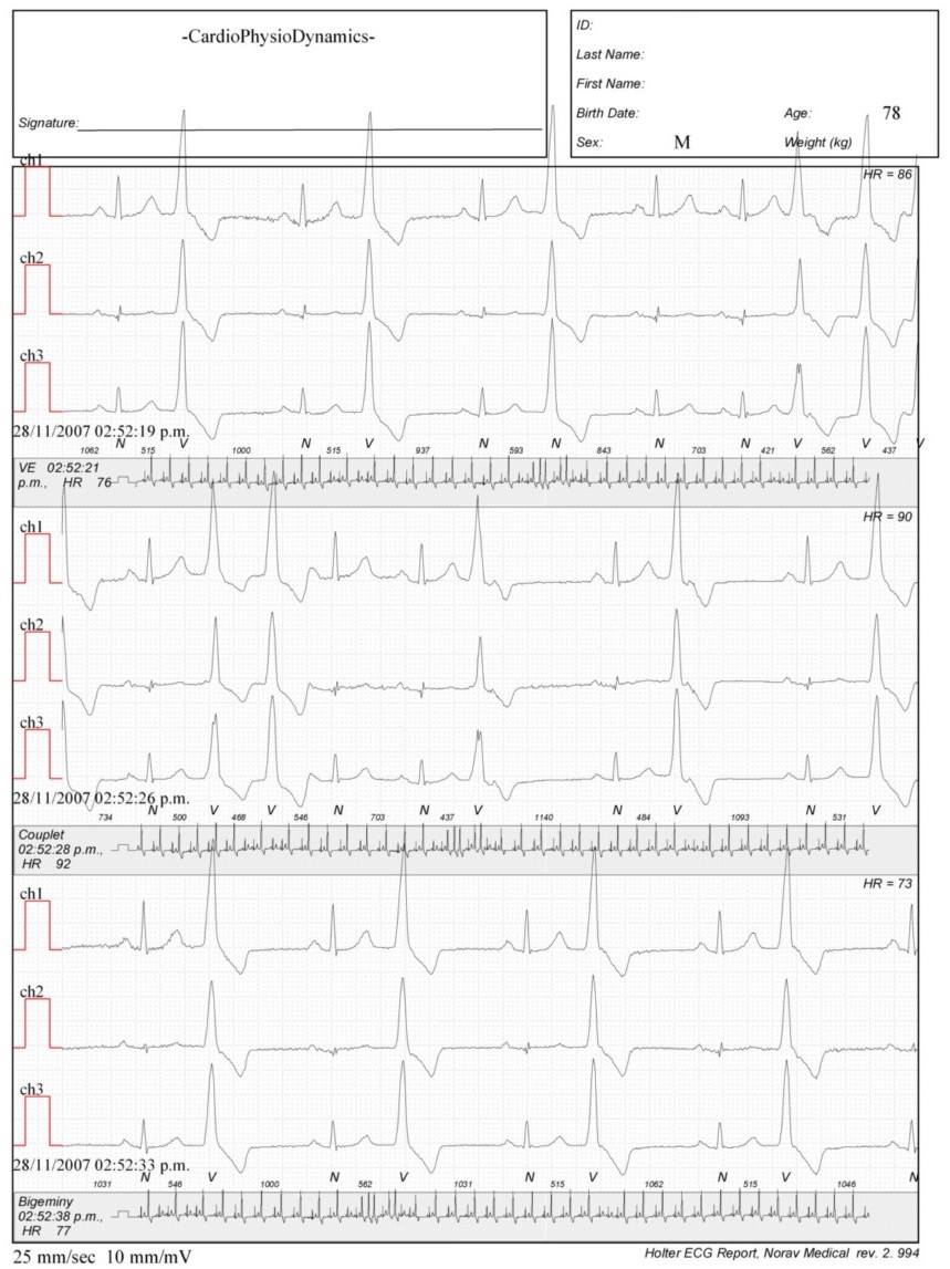 Martinez.Duncker.ECG1_1.jpg