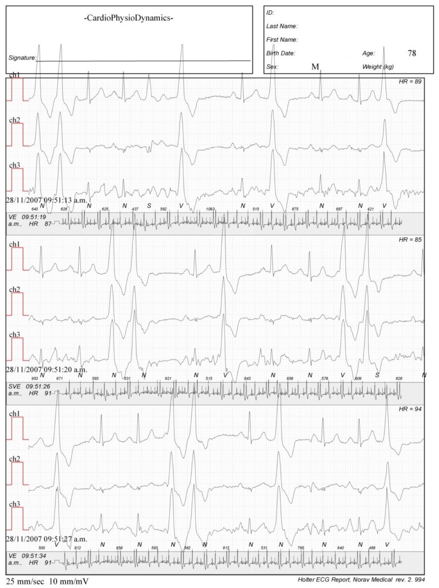 Martinez.Duncker.ECG1_1.jpg