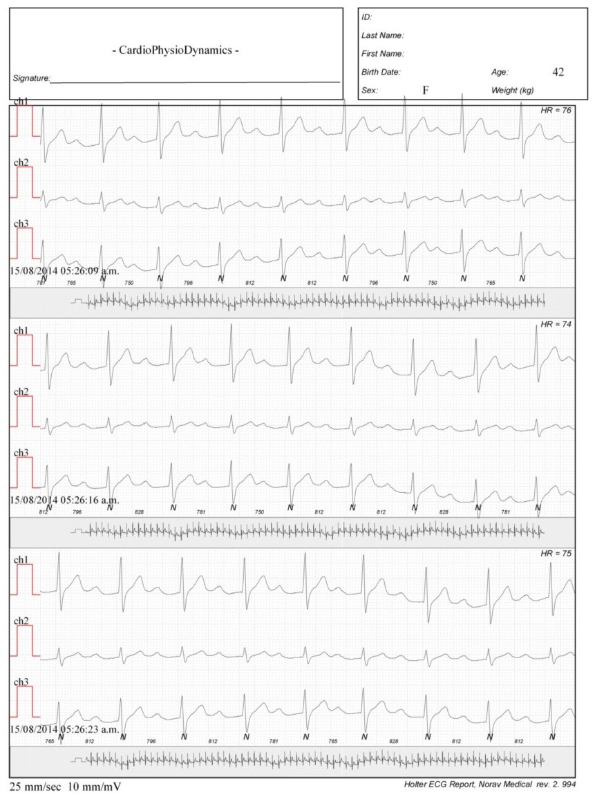 Martinez.Duncker.ECG1_1.jpg