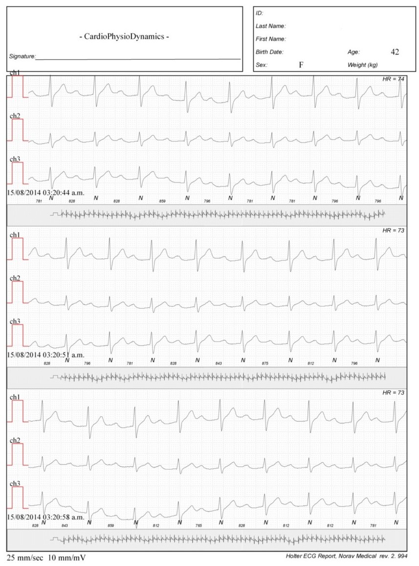 Martinez.Duncker.ECG1_1.jpg