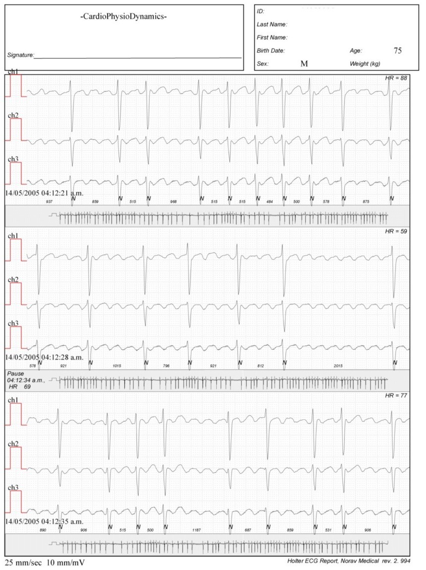 Martinez.Duncker.ECG1_1.jpg