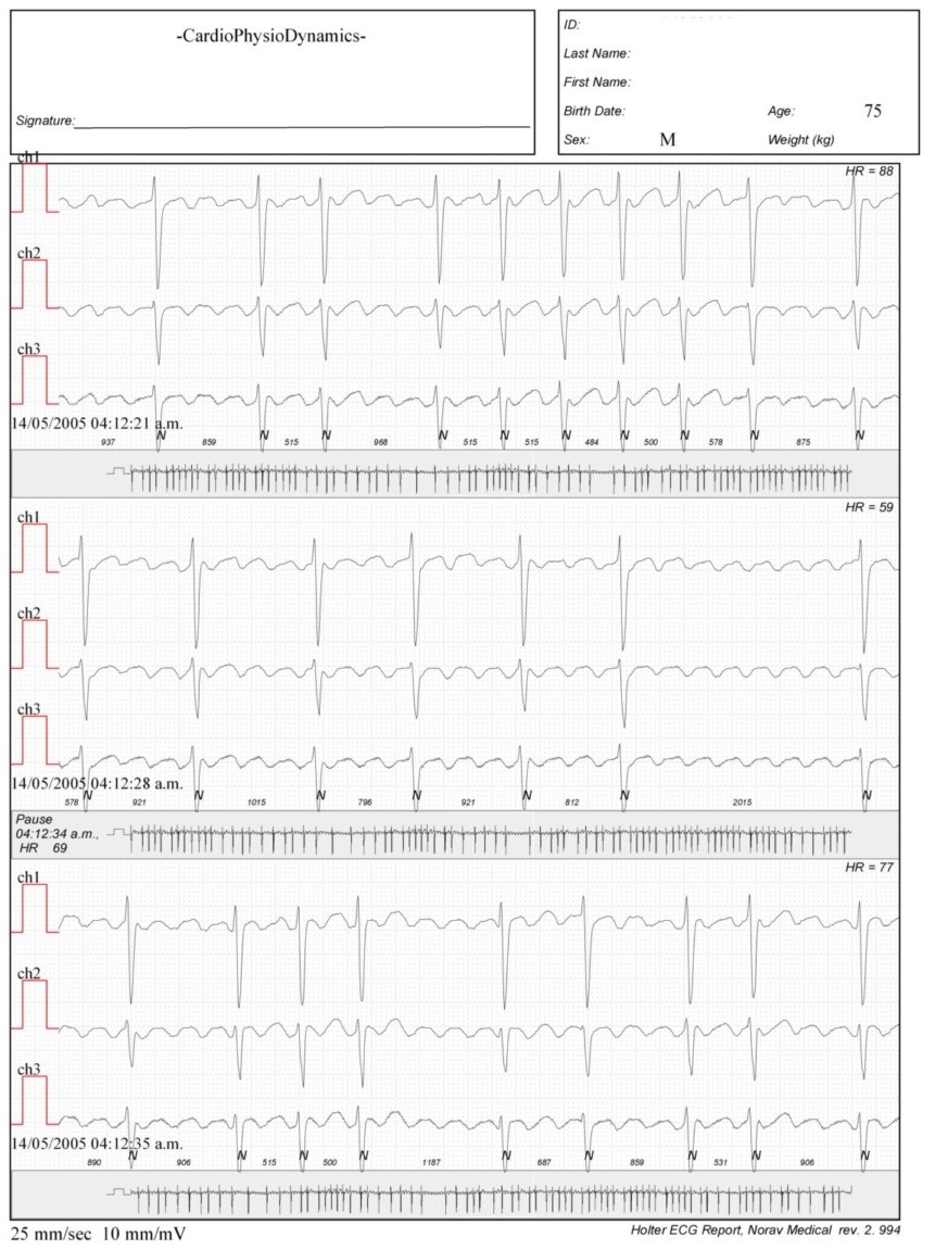 Martinez.Duncker.ECG1_1.jpg